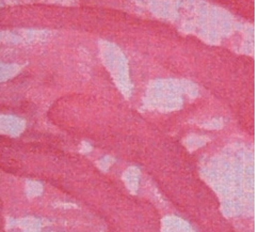 [Body Cooler 314] Body Cooling Neck Wrap Red Tie Dye